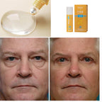 Rolon 5 em 1 Ultra Rejuvenescedor Luteína Inova® PAGUE 1 LEVE 3