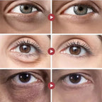 Rolon 5 em 1 Ultra Rejuvenescedor Luteína Inova® PAGUE 1 LEVE 3
